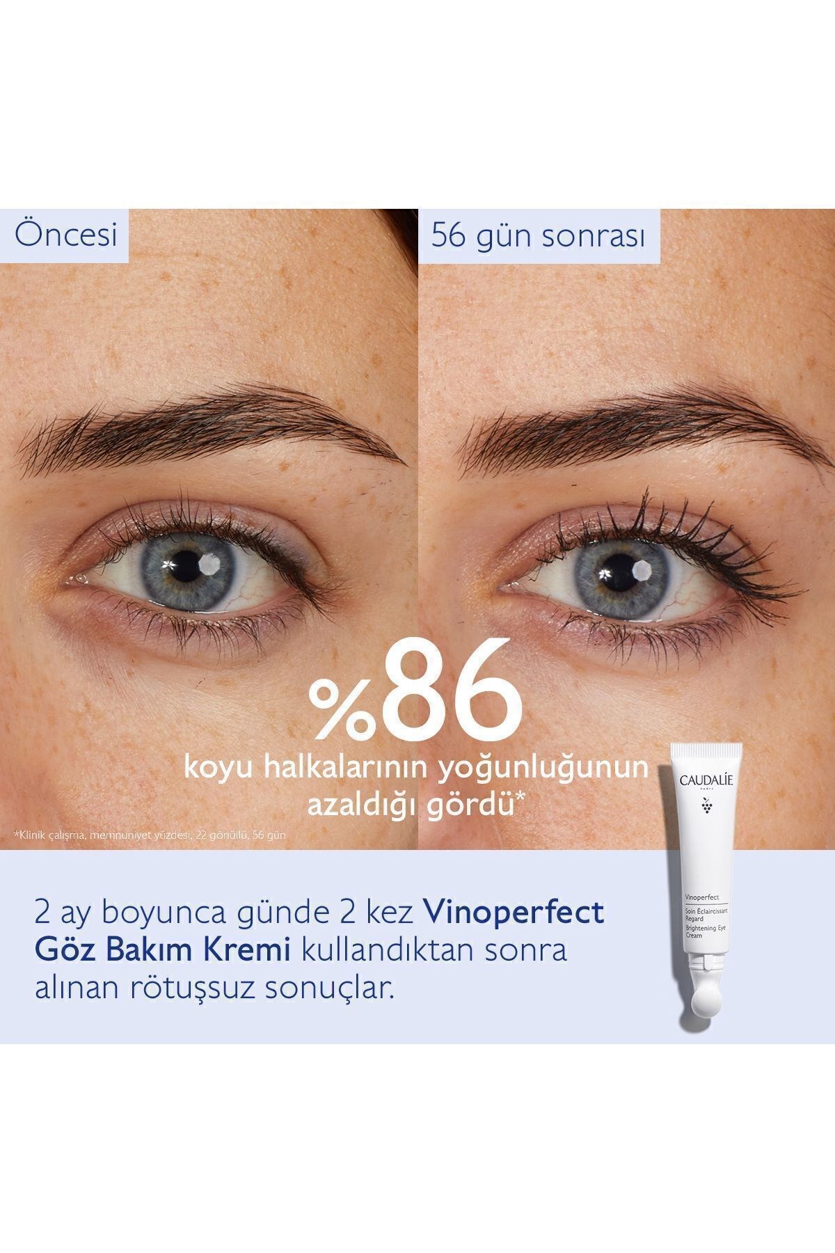 Caudalie Vinoperfect Brightening Eye Cream 15 ml